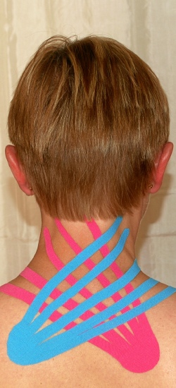 Kinesiotape-Anwendung